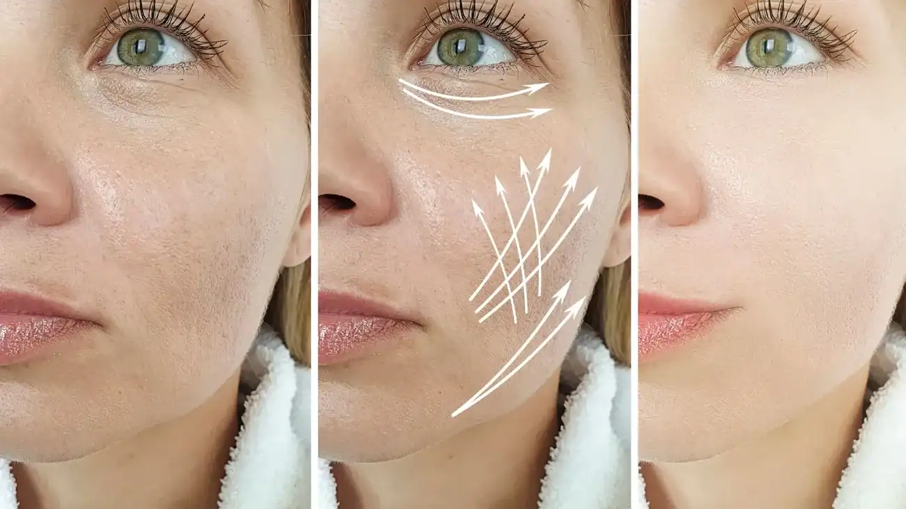Can One Treatment Really Tackle More Than One Skin Concern Hickstead?