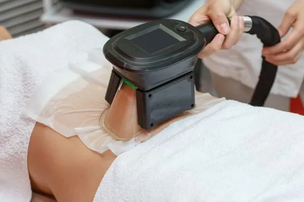 Image of person having fat freezing treatment to help weight gain Hickstead