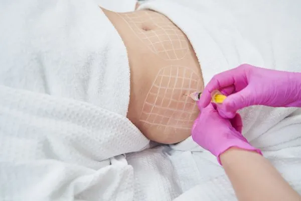 image of fat dissolving injections on love handles to help combat weight gain Hickstead