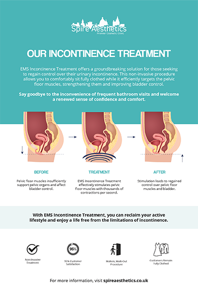 image of how urge incontinence Hickstead treatment works