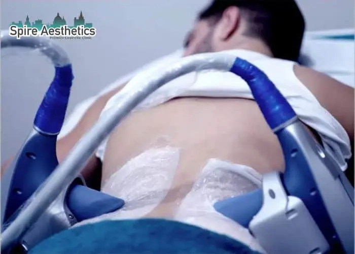 Man having fat freezing treatment done on love handles before a competitions Hickstead to create a sculpted look.
